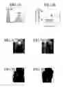 Fig. 08 - Immunoconjugates targeting syndecan-1 expressing cells and use thereof