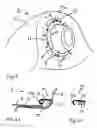 Fig. 02 - Method for protecting a vehicle body from corrosion