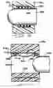 Fig. 09 - One piece header assembly for an implantable medical device