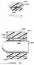 Fig. 10 - One piece header assembly for an implantable medical device
