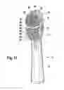 Fig. 08 - Electric toothbrush and corresponding toothbrush head