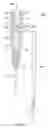 Fig. 04 - Self-stripping FCC riser cyclone