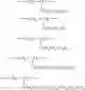 Fig. 06 - Ink set for use in ink-jet recording, ink-jet recording process, recording unit and ink-jet recording apparatus
