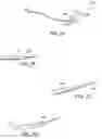 Fig. 06 - Suture passer