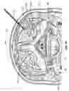 Fig. 45 - Methods for selective stimulation of a ganglion