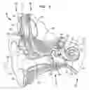 Fig. 02 - Multiple channel-electrode mapping