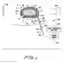 Fig. 02 - Apparatus and method for treatment of an intervertebral disc