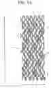 Fig. 02 - Intravascular, indwelling instrument