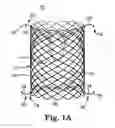Fig. 02 - Replacement prosthetic heart valve, system and method of implant