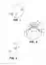 Fig. 02 - Valve to myocardium tension members device and method