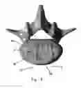 Fig. 08 - Intervertebral disc prosthesis