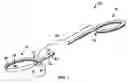 Fig. 02 - Open lumen stents