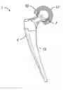 Fig. 01 - Plasma sprayed porous coating for medical implants