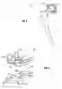 Fig. 02 - Plasma sprayed porous coating for medical implants