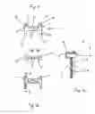 Fig. 02 - Holder for a heat exchanger