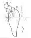 Fig. 13 - Decoy and support therefor