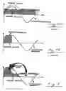 Fig. 02 - Inhalation nebulizer