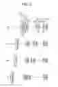 Fig. 03 - Zoom lens system