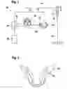 Fig. 02 - Bite device used with a panorama X-ray device