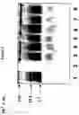Fig. 04 - Compositions and methods for eliciting an immune response to gram-negative bacterial infections