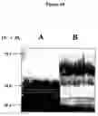 Fig. 11 - Compositions and methods for eliciting an immune response to gram-negative bacterial infections