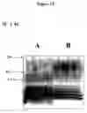 Fig. 14 - Compositions and methods for eliciting an immune response to gram-negative bacterial infections