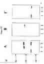 Fig. 15 - Compositions and methods for eliciting an immune response to gram-negative bacterial infections
