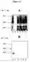 Fig. 17 - Compositions and methods for eliciting an immune response to gram-negative bacterial infections