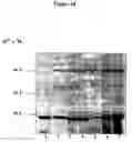 Fig. 20 - Compositions and methods for eliciting an immune response to gram-negative bacterial infections