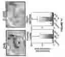Fig. 12 - Antibodies directed against amyloid-beta peptide