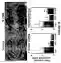 Fig. 13 - Antibodies directed against amyloid-beta peptide