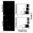 Fig. 14 - Antibodies directed against amyloid-beta peptide