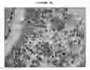 Fig. 03 - Human malignant cystosarcoma phyllodes derived mouse cell line