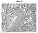 Fig. 04 - Human malignant cystosarcoma phyllodes derived mouse cell line