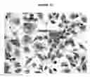 Fig. 05 - Human malignant cystosarcoma phyllodes derived mouse cell line