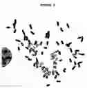 Fig. 09 - Human malignant cystosarcoma phyllodes derived mouse cell line