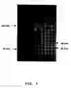Fig. 05 - Method of identification and quantification of proteins, isoforms of the angiotensin I converting enzyme