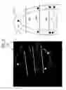 Fig. 08 - Three dimensional atrium-ventricle plane detection