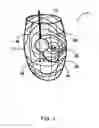 Fig. 06 - Mapping physiological data in a heart chamber