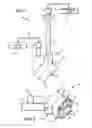 Fig. 02 - Apparatus and method for cleaning a surgically prepared, concave bone surface