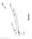 Fig. 09 - Catheter treatment stylet