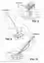 Fig. 05 - Pod apparatus
