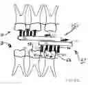 Fig. 10 - Oral brushing devices and/or methods