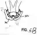 Fig. 13 - Oral brushing devices and/or methods