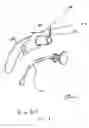 Fig. 02 - Tracheostomy tube with improved tie and method holding same