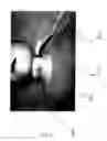 Fig. 07 - Tracheostomy tube with improved tie and method holding same