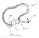 Fig. 08 - Tracheostomy tube with improved tie and method holding same