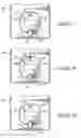 Fig. 06 - Battery-powered electronic device with spaced contact extensions
