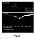 Fig. 07 - Reduced-time variable rate excitation pulses for rapid MRI
