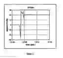 Fig. 03 - System and method for locating an anomaly